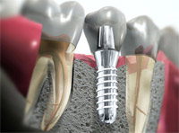 стоматология в Мытищах