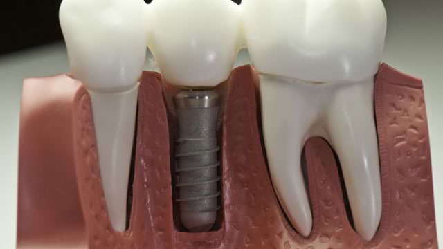 Имплантация зубов Мытищи